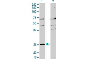 Western Blot analysis of MS4A2 expression in transfected 293T cell line by MS4A2 monoclonal antibody (M02), clone 3B1.