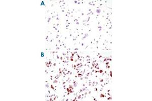 Immunocytochemistry analysis of HCC827 cells, untransfected (A) or transfected with GFP (B) using GFP monoclonal antibody, clone 4B10B2 .