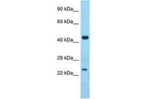 Image no. 1 for anti-Abhydrolase Domain Containing 12 (ABHD12) (C-Term) antibody (ABIN6748336)