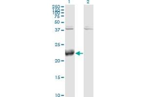 Western Blot analysis of ATF3 expression in transfected 293T cell line by ATF3 monoclonal antibody (M04), clone 8G5.