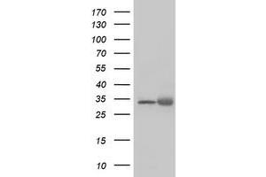 Western Blotting (WB) image for anti-Exosome Component 7 (EXOSC7) antibody (ABIN1498142) (EXOSC7 Antikörper)