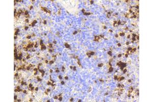 Immunohistochemistry of paraffin-embedded human spleen using LYZ antibody. (LYZ Antikörper)