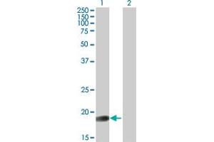 Western Blot analysis of GLYAT expression in transfected 293T cell line by GLYAT MaxPab polyclonal antibody. (GLYAT Antikörper  (AA 1-163))