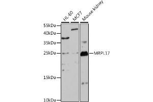 Western blot analysis of extracts of various cell lines, using MRPL17 antibody (ABIN7268559) at 1:1000 dilution. (MRPL17 Antikörper  (AA 86-175))