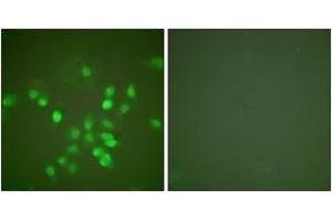 Immunofluorescence analysis of A549 cells, using PML Antibody. (PML Antikörper  (AA 11-60))