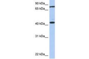 Image no. 1 for anti-Testis Expressed 9 (TEX9) (AA 287-336) antibody (ABIN6743917) (TEX9 Antikörper  (AA 287-336))