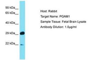 Image no. 1 for anti-phosphoglycerate Mutase 1 (Brain) (PGAM1) (C-Term) antibody (ABIN6750470)