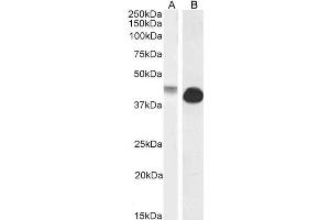 ABIN570972 (0. (Connexin 43/GJA1 Antikörper  (Internal Region))