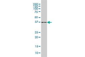 AKR1B10 monoclonal antibody (M01), clone 1A6 Western Blot analysis of AKR1B10 expression in HepG2 . (AKR1B10 Antikörper  (AA 76-143))