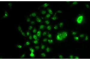 Immunofluorescence analysis of U2OS cells using NELFE Polyclonal Antibody (RDBP Antikörper)