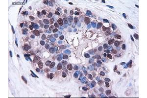 Immunohistochemical staining of paraffin-embedded breast using anti-HES1 (TA000114) mouse monoclonal antibody. (HES1 Antikörper  (AA 1-280))