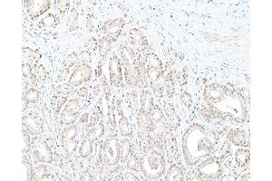Immunohistochemistry (IHC) image for anti-Denticleless E3 Ubiquitin Protein Ligase Homolog (DTL) (C-Term) antibody (ABIN7454696) (CDT2/RAMP Antikörper  (C-Term))