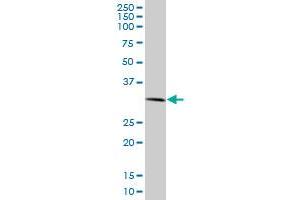 RNF2 monoclonal antibody (M09), clone 4A12. (RNF2 Antikörper  (AA 192-290))