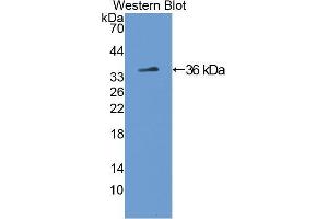 Western blot analysis of the recombinant protein. (Tyrosine Hydroxylase Antikörper  (AA 34-301))