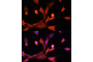 Immunofluorescence (IF) image for anti-Adenosine Kinase (ADK) (AA 200-345) antibody (ABIN7265462)