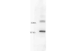 Anti IL-10 whole antiserum  was tested against recombinant IL10. (IL-10 Antikörper)