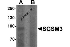 Western Blotting (WB) image for anti-Small G Protein Signaling Modulator 3 (SGSM3) (N-Term) antibody (ABIN1077375) (SGSM3 Antikörper  (N-Term))