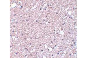 Immunohistochemistry staining of human brain tissue (Paraffin section) with TMEM184A Antibody   at 5 μg/ml. (TMEM184A Antikörper  (C-Term))