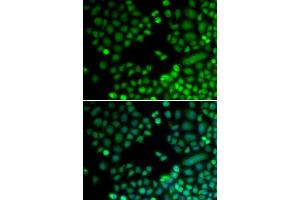 Immunofluorescence (IF) image for anti-RAD9 Homolog A (S. Pombe) (RAD9A) (AA 162-391) antibody (ABIN3022652)