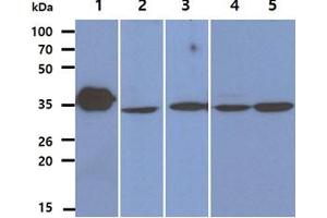 The Recombinant Human LDHB (50ng) and Cell lysates (40ug) were resolved by SDS-PAGE, transferred to PVDF membrane and probed with anti-human LDHB antibody (1:1000).