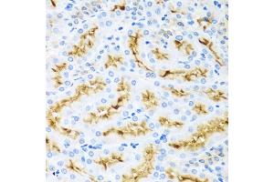 Immunohistochemistry of paraffin-embedded rat kidney using CCL22 antibody (ABIN5974972) at dilution of 1/100 (40x lens).