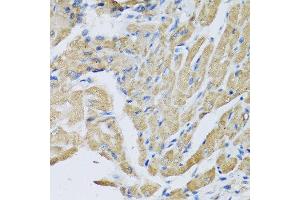 Immunohistochemistry of paraffin-embedded mouse heart using CRHBP antibody at dilution of 1:100 (40x lens). (CRHBP Antikörper)