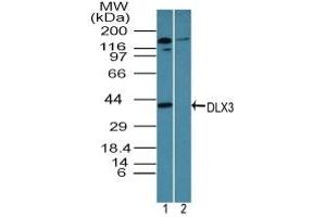 Image no. 1 for anti-Distal-Less Homeobox 3 (DLX3) (AA 220-270) antibody (ABIN960137) (DLX3 Antikörper  (AA 220-270))