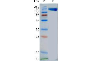 SDS-PAGE (SDS) image for Toll-Like Receptor 3 (TLR3) (AA 28-80) protein (mFc Tag) (ABIN7092692)