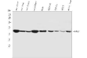 Western blot analysis of ACAA2 using anti-ACAA2 antibody (ABIN4886414). (ACAA2 Antikörper  (Middle Region))