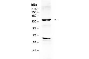 Western blot analysis of ErbB 2 using anti- ErbB 2 antibody . (ErbB2/Her2 Antikörper  (N-Term))