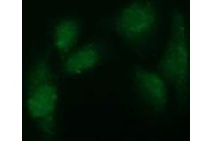 Immunofluorescence (IF) image for anti-ADAM Metallopeptidase with thrombospondin Type 1 Motif, 8 (ADAMTS8) antibody (ABIN2715723) (ADAMTS8 Antikörper)