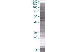 IFIT2 transfected lysate. (IFIT2 293T Cell Transient Overexpression Lysate(Denatured))
