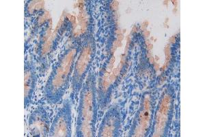 Used in DAB staining on fromalin fixed paraffin- embedded intestine tissue (KRT20 Antikörper  (AA 75-382))