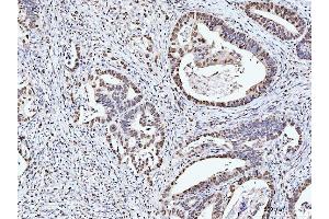 IHC analysis of MCM6 using anti-MCM6 antibody (ABIN7600038). (MCM6 Antikörper  (AA 14-821))