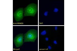 ABIN571262 Immunofluorescence analysis of paraformaldehyde fixed U2OS cells, permeabilized with 0.