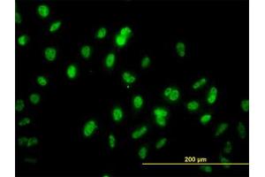 Image no. 1 for anti-GA Binding Protein Transcription Factor, alpha Subunit 60kDa (GABPA) (AA 1-101) antibody (ABIN598704) (GABPA Antikörper  (AA 1-101))