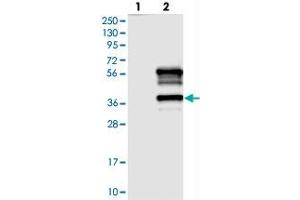 Western blot analysis of Lane 1: Negative control (vector only transfected HEK293T lysate), Lane 2: Over-expression Lysate (Co-expressed with a C-terminal myc-DDK tag (~3. (TTC19 Antikörper)