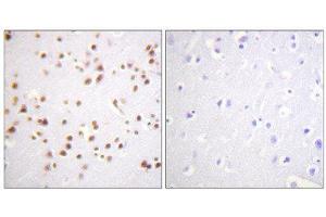 Immunohistochemistry (IHC) image for anti-Catenin (Cadherin-Associated Protein), delta 1 (CTNND1) (Tyr228) antibody (ABIN1848016)