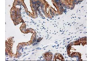 Image no. 5 for anti-BAI1-Associated Protein 2 (BAIAP2) antibody (ABIN1496805) (BAIAP2 Antikörper)