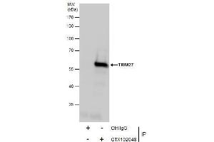 IP Image Immunoprecipitation of TRIM27 protein from Jurkat whole cell extracts using 5 μg of TRIM27 antibody, Western blot analysis was performed using TRIM27 antibody, EasyBlot anti-Rabbit IgG  was used as a secondary reagent. (TRIM27 Antikörper)