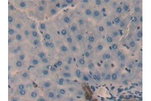 Detection of GAL2 in Rat Liver Tissue using Polyclonal Antibody to Galectin 2 (GAL2) (Gallinacin-2 (GAL2) (AA 1-130) Antikörper)