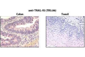 Immunohistochemistry detection of endogenous TRAIL-R3 in paraffin-embedded human carcinoma tissues (colon, tonsil) using mAb to TRAIL-R3 (TR3. (DcR1 Antikörper)