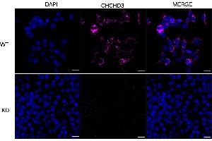 anti-Coiled-Coil-Helix-Coiled-Coil-Helix Domain Containing 3 (CHCHD3) antibody