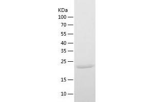 Western Blotting (WB) image for Ubiquitin Specific Peptidase 35 (USP35) (AA 56-264) protein (His tag) (ABIN7125595) (USP35 Protein (AA 56-264) (His tag))