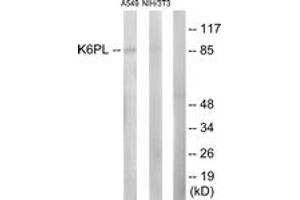 Western blot analysis of extracts from A549/NIH-3T3 cells, using K6PL Antibody.