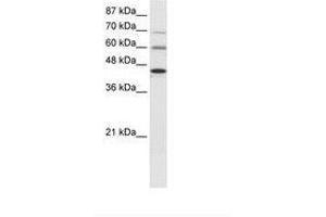 Image no. 1 for anti-Protein Arginine Methyltransferase 3 (PRMT3) (AA 221-270) antibody (ABIN6736023) (PRMT3 Antikörper  (AA 221-270))