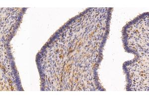 Detection of TGM2 in Human Uterus Tissue using Polyclonal Antibody to Transglutaminase 2 (TGM2) (Transglutaminase 2 Antikörper  (AA 1-687))