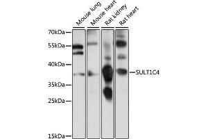 Western blot analysis of extracts of various cell lines, using SULT1C4 antibody (ABIN7270630) at 1:1000 dilution.