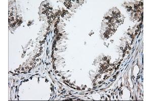 Immunohistochemical staining of paraffin-embedded Human pancreas tissue using anti-TACC3 mouse monoclonal antibody. (TACC3 Antikörper)