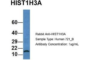 Host: Rabbit Target Name: HIST1H3A Sample Type: Human 721_B Antibody Dilution: 1. (HIST1H3A Antikörper  (N-Term))